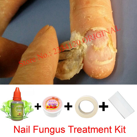 Chinese Medicine Herbs Toe Nail Fungus Treatment Anti Fungal Nail Infection Essence Nail Treatment Removal Nail Care Lotion