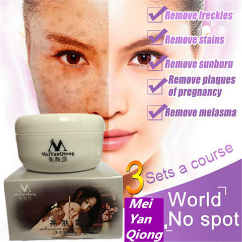 Strong Effects Powerful Whitening Freckle Cream 40g Remove Melasma Acne Spots Pigment Melanin Face Care Cream 1pcs